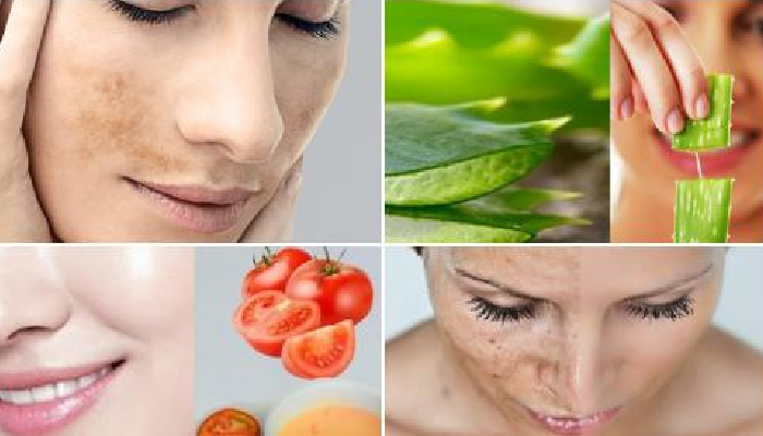 8 remedios caseros para quitar las manchas de sol de la cara: