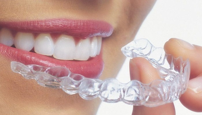 Cómo quitar manchas de los dientes-acudir al odontologo